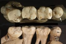 Neandertalci su koristili čačkalice u borbi protiv zubobolje?
