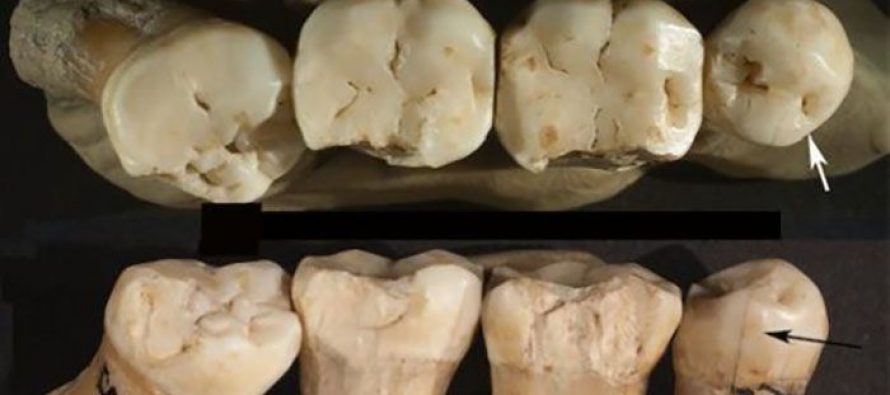 Neandertalci su koristili čačkalice u borbi protiv zubobolje?